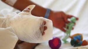 Antioquia refuerza llamado a no usar pólvora: ya son 189 personas lesionadas